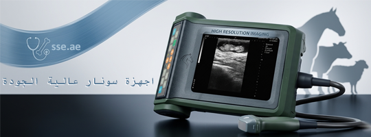 سونار فحص الحمل