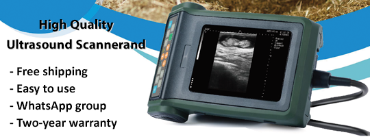 Ultrasound