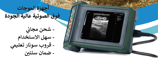 سونار فحص الحمل